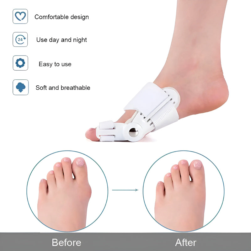 Bunion Splint and Big Toe Straightener – Orthopedic Hallux